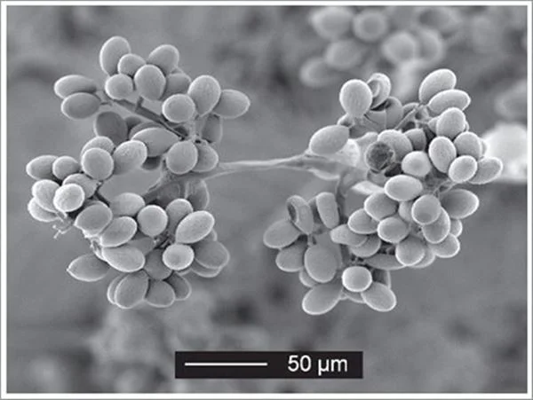 Plasmopara Viticola | microsope photo